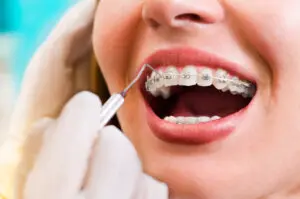 mansfield orthodontics