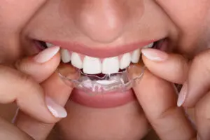 airway orthodontic treatment in Mansfield, TX