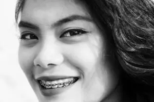 woman with braces
