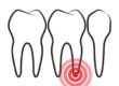 root canal | Crosspointe Dental | Mansfield TX