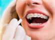mansfield orthodontics
